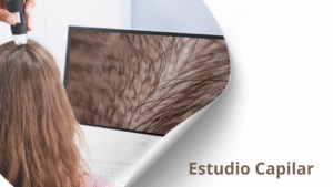 renacer capilar, tratamientos para la alopecia y caida del cabelloe en hombres y mujeres en costa rica (4)